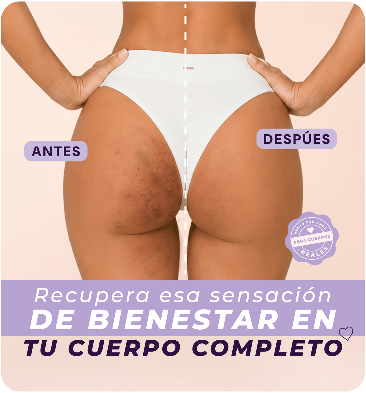 Gel de glúteos